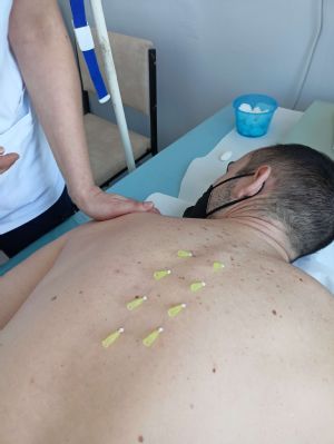 Liečba biodermálnymi niťami spája modernú medicínu s alternatívnou akupunktúrou, doplnkovú terapiu aplikujú pacientom aj v handlovskej nemocnici
